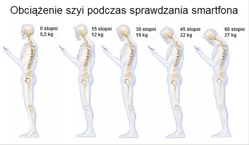 Co częste sprawdzanie smartfona robi z twoją szyją?