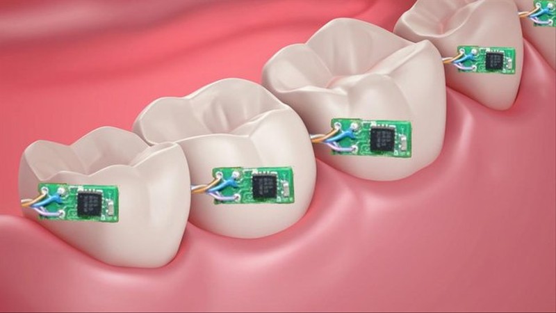 Mikroprocesory na zębach - nie oszukasz już dentysty